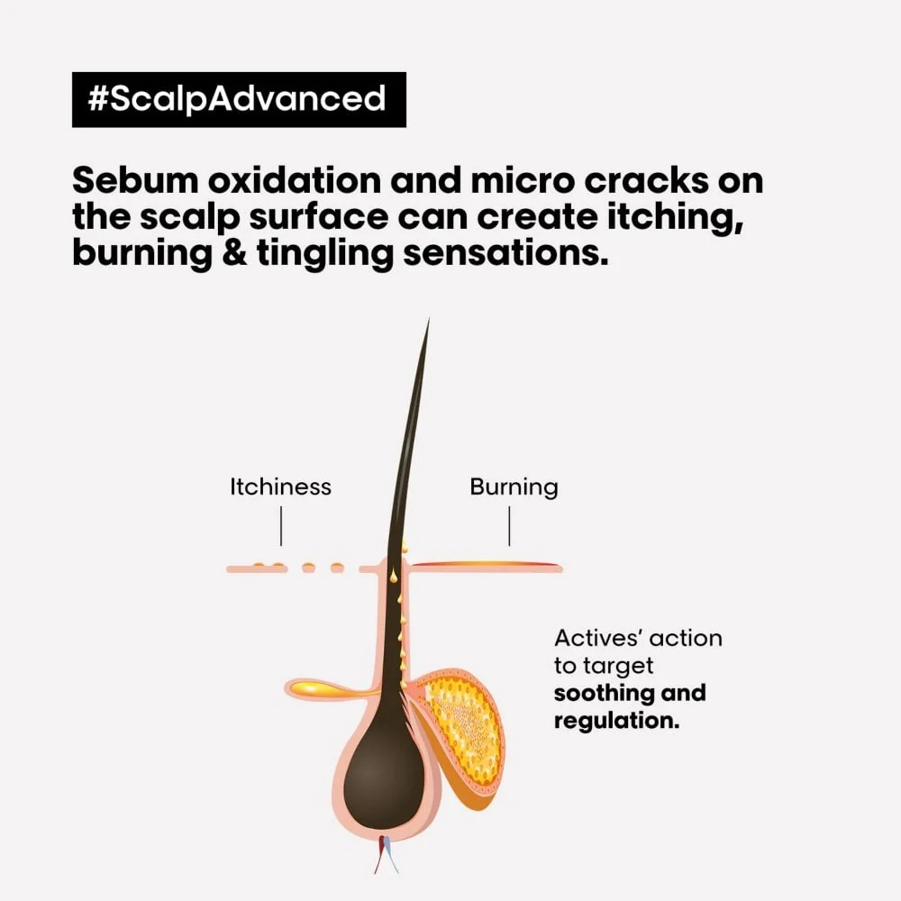 L'Oreal Professionnel Serie Expert Scalp Advanced Anti-Discomfort Intense Soother Hair Treatment 200ml - Image 3