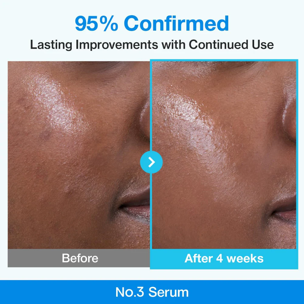 Numbuzin No. 3 Blue Bio-Retinol Pore Refining Serum 30ml - Image 5