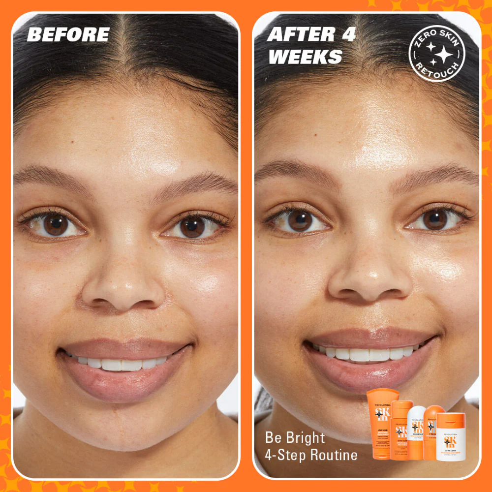 Revolution Skincare Brighten Up Vitamin C Brightening Serum 30ml - Image 4