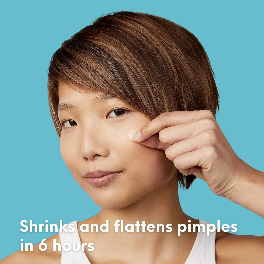 Skin Choice Breakout Classic Acne Spot Pimple Patches x30 - Image 9